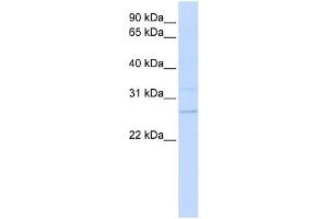 TMEM126B antibody used at 1 ug/ml to detect target protein. (TMEM126B 抗体  (N-Term))
