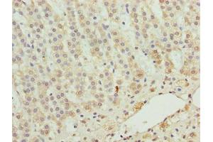 Immunohistochemistry of paraffin-embedded human adrenal gland tissue using ABIN7176171 at dilution of 1:100 (ZNF226 抗体  (AA 1-94))