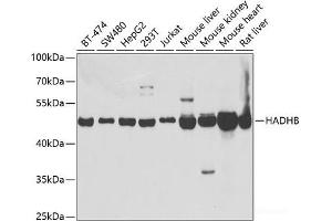 Western blot analysis of extracts of various cell lines using HADHB Polyclonal Antibody at dilution of 1:1000. (HADHB 抗体)