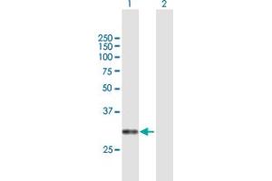 Western Blot analysis of CACNG6 expression in transfected 293T cell line by CACNG6 MaxPab polyclonal antibody. (CACNG6 抗体  (AA 1-260))