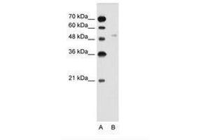 Image no. 2 for anti-Solute Carrier Family 2 (Facilitated Glucose Transporter), Member 6 (SLC2A6) (AA 351-400) antibody (ABIN205018) (SLC2A6 抗体  (AA 351-400))