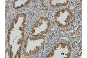 Immunoperoxidase of monoclonal antibody to NDRG1 on formalin-fixed paraffin-embedded human endometrium. (NDRG1 抗体  (AA 1-394))