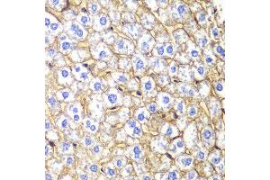 Immunohistochemistry of paraffin-embedded mouse liver using CDH2 antibody at dilution of 1:100 (400x lens). (N-Cadherin 抗体)