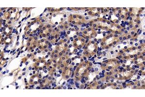 Immunohistochemistry (IHC) image for anti-Sirtuin 5 (SIRT5) (AA 37-310) antibody (ABIN7437188)