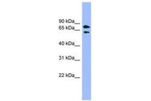 Image no. 1 for anti-Pantothenate Kinase 4 (PANK4) (AA 359-408) antibody (ABIN6744130) (PANK4 抗体  (AA 359-408))