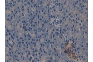 Immunohistochemistry (IHC) image for anti-TNF Receptor-Associated Factor 2 (TRAF2) (AA 238-491) antibody (ABIN7443455)