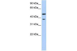 MAGEA3 antibody used at 1 ug/ml to detect target protein. (MAGEA3 抗体  (Middle Region))
