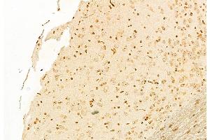 ABIN6262026 and ABIN6278470 at 1/100 staining Mouse brain tissue by IHC-P.