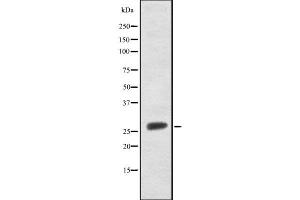Western blot analysis FRAT1 using Jurkat whole cell lysates (FRAT1 抗体  (C-Term))