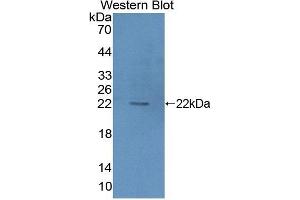Detection of Recombinant HIBCH, Mouse using Polyclonal Antibody to 3-Hydroxyisobutyryl Coenzyme A Hydrolase (HIBCH) (HIBCH 抗体  (AA 1-170))