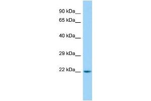 WB Suggested Anti-ARL15 Antibody Titration: 1. (ARL15 抗体  (C-Term))