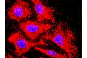 Proximity Ligation Analysis of protein-protein interactions between INHBB and ACVR1C. (INHBB 抗体  (AA 1-407))