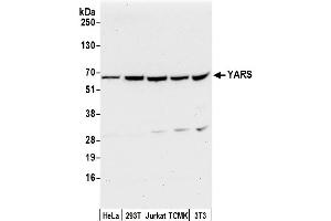 Western Blotting (WB) image for anti-Tyrosyl-tRNA Synthetase (Yars) (AA 1-50) antibody (ABIN7450914)