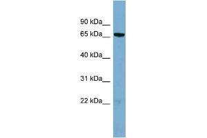 WB Suggested Anti-HP1BP3 Antibody Titration: 0. (HP1BP3 抗体  (N-Term))