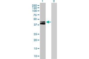 Western Blot analysis of RTN4IP1 expression in transfected 293T cell line by RTN4IP1 MaxPab polyclonal antibody. (RTN4IP1 抗体  (AA 1-396))