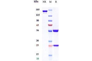 Anti-MER / MERTK Reference Antibody (RGX-019) on SDS-PAGE under reducing (R) condition.