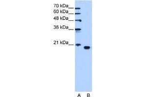 PEBP1 antibody used at 1. (PEBP1 抗体  (C-Term))