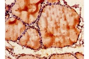 Immunohistochemistry of paraffin-embedded human thyroid tissue using ABIN7170408 at dilution of 1:100 (SNX9 抗体  (AA 85-200))