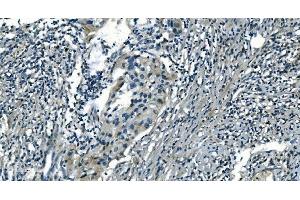 IHC analysis of PI-16/PI16 using anti-PI-16/PI16 antibody (ABIN7601074).