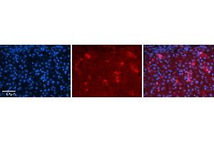 Immunohistochemistry (IHC) image for anti-Y Box Binding Protein 1 (YBX1) (C-Term) antibody (ABIN2784387)