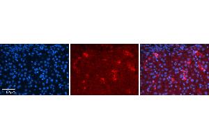 Rabbit Anti-YBX1 Antibody Catalog Number: ARP50946_P050 Formalin Fixed Paraffin Embedded Tissue: Human Liver Tissue Observed Staining: Cytoplasm in Kupffer cells in sinusoids Primary Antibody Concentration: 1:100 Other Working Concentrations: 1:600 Secondary Antibody: Donkey anti-Rabbit-Cy3 Secondary Antibody Concentration: 1:200 Magnification: 20X Exposure Time: 0. (YBX1 抗体  (C-Term))