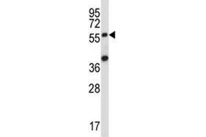 SOCS6 antibody western blot analysis in 293 lysate. (SOCS6 抗体  (AA 40-69))