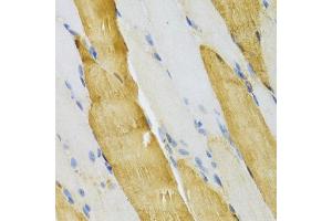 Immunohistochemistry of paraffin-embedded mouse skeletal muscle using PVALB Antibody (ABIN5971476) at dilution of 1/100 (40x lens). (PVALB 抗体)