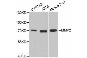Western blot analysis of extracts of various cell lines, using MMP2 antibody. (MMP2 抗体)
