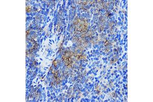 Immunohistochemistry (IHC) image for anti-Signal Transducer and Activator of Transcription 4 (STAT4) (AA 600-700) antibody (ABIN1682909)
