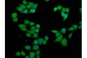 Immunofluorescence staining of Hela cells with ABIN7168176 at 1:66, counter-stained with DAPI. (RPS6KA2 抗体  (AA 228-395))
