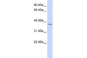 WB Suggested Anti-KCNAB2 Antibody Titration:  0. (KCNAB2 抗体  (Middle Region))