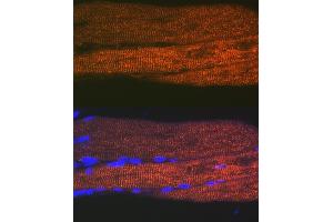 Immunofluorescence analysis of rat bone marrow cells using SERC/ Rabbit mAb (9639) at dilution of 1:100 (40x lens). (ATP2A1/SERCA1 抗体)