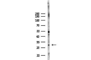 anti-Kv Channel Interacting Protein 2 (KCNIP2) antibody