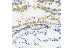Immunohistochemistry of paraffin-embedded mouse lung using IFNL3 antibody at dilution of 1:100 (40x lens). (IL28B 抗体)