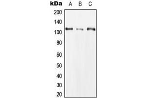 Western blot analysis of CLCN1 expression in Hela (A), NIH3T3 (B), H9C2 (C) whole cell lysates.