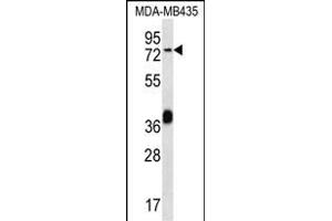 CEL Antibody (Center) (ABIN656486 and ABIN2837867) western blot analysis in MDA-M cell line lysates (35 μg/lane). (Cholesterol Esterase 抗体  (AA 454-482))