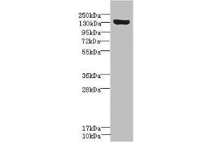 Western blot All lanes: SCN8A antibody IgG at 1. (SCN8A 抗体  (AA 1350-1440))