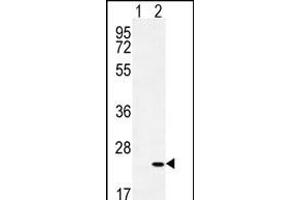 Western blot analysis of CRH (arrow) using rabbit polyclonal CRH Antibody (C-term) (ABIN655191 and ABIN2844807). (CRH 抗体  (C-Term))