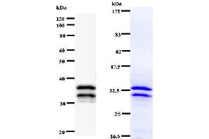 Left: NR4A1staining.