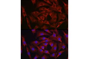 Immunofluorescence analysis of NIH-3T3 cells using MARCKS Rabbit pAb (ABIN6134393, ABIN6143555, ABIN6143556 and ABIN6214033) at dilution of 1:100 (40x lens). (MARCKS 抗体  (AA 1-100))