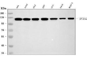Western blot analysis of SF3A1 using anti-SF3A1 antibody (ABIN7600556). (SF3A1 抗体  (AA 20-556))