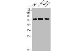 Western Blot analysis of K562 SH-SY5Y mouse-brain cells using E-Selectin Polyclonal Antibody diluted at 1:500. (Selectin E/CD62e 抗体)