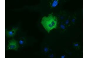 Anti-DYNC1LI1 mouse monoclonal antibody (ABIN2452965) immunofluorescent staining of COS7 cells transiently transfected by pCMV6-ENTRY DYNC1LI1 (RC222010). (DYNC1LI1 抗体)