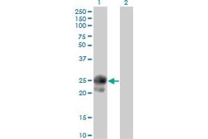 Western Blot analysis of BAMBI expression in transfected 293T cell line by BAMBI monoclonal antibody (M01), clone 3C1-1D1.