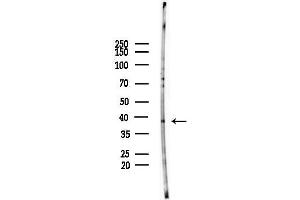 anti-Histone Deacetylase 11 (HDAC11) (Internal Region) antibody