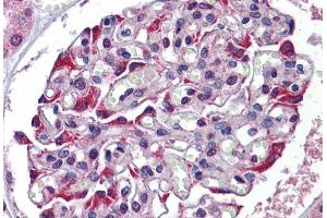 Immunohistochemistry (IHC) image for anti-Tryptophan 2,3-Dioxygenase (TDO2) (N-Term) antibody (ABIN2782334)