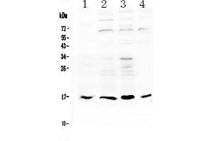 Western blot analysis of IL17B using anti-IL17B antibody .