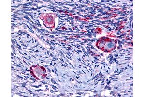 Anti-NUR77 antibody IHC of human ovary. (NR4A1 抗体  (N-Term))