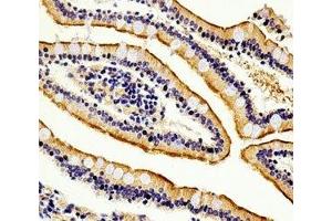 Immunohistochemical analysis of paraffin-embedded human small intestine section using anti-Alkaline Phosphatase antibody diluted at 1:100 dilution. (Alkaline Phosphatase 抗体  (AA 274-304))