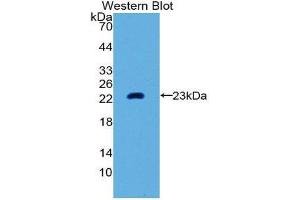 Western Blotting (WB) image for anti-Matrix Metallopeptidase 3 (Stromelysin 1, Progelatinase) (MMP3) (AA 289-452) antibody (ABIN1859854) (MMP3 抗体  (AA 289-452))